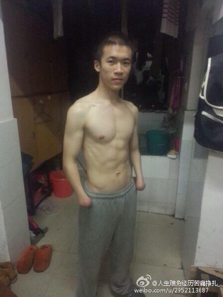 励志玩家,肢体障碍,DOTA2最新图片